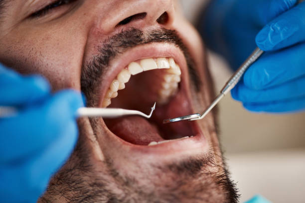 Best Emergency Treatment for Dental Infections or Abscesses in Princevle, IL